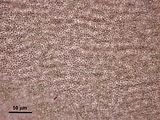 5 – Cellule corticali in visione superficiale
